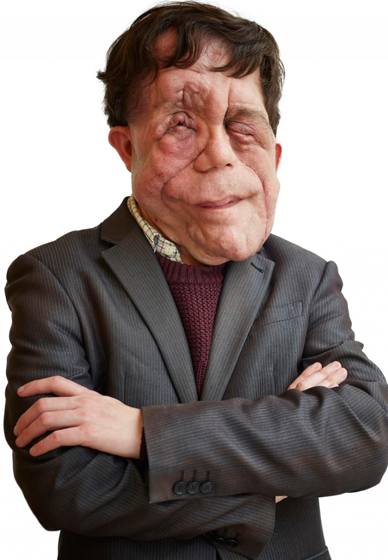 Adam Pearson Bio, family, net worth