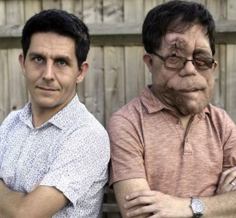 Adam Pearson with his brother Neil Pearson